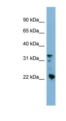 Western Blot: CRYBB3 Antibody [NBP1-55088]