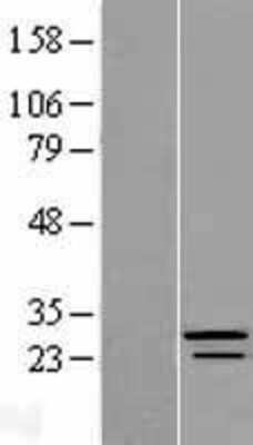 Western Blot: CRYBB3 Overexpression Lysate [NBP2-07916]