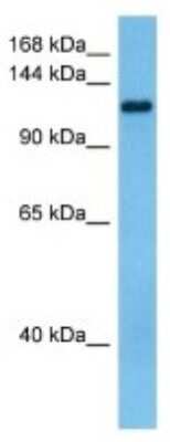 Western Blot: CRYBG3 Antibody [NBP3-10851]