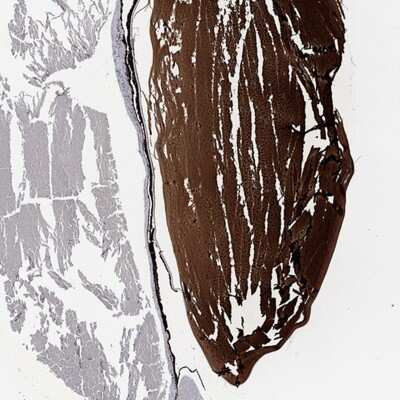 Immunohistochemistry-Paraffin: CRYGA Antibody [NBP3-17113]