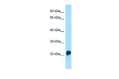 Western Blot: CRYGA Antibody [NBP3-09445]