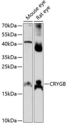 Western Blot: CRYGB AntibodyAzide and BSA Free [NBP2-92172]