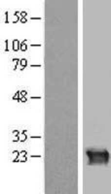 Western Blot: CRYGB Overexpression Lysate [NBP2-07779]