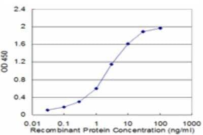 ELISA: CRYGD Antibody (2H3) [H00001421-M04]