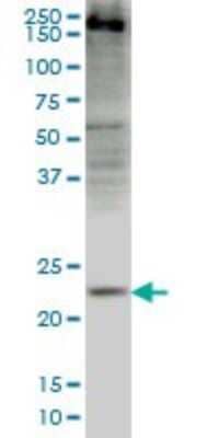 Western Blot: CRYGD Antibody (4E12) [H00001421-M03]