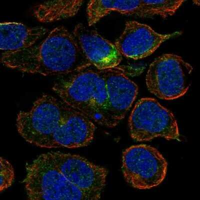 Immunocytochemistry/ Immunofluorescence: CRYGD Antibody [NBP2-68641]