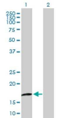 Western Blot: CRYGD Antibody [H00001421-B01P]