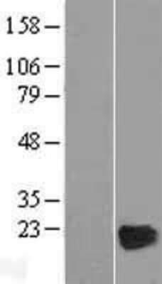 Western Blot: CRYGD Overexpression Lysate [NBP2-07561]