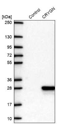 Western Blot: CRYGN Antibody [NBP2-14708]