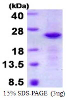 SDS-PAGE: Recombinant Human CRYGN His Protein [NBP2-22964]