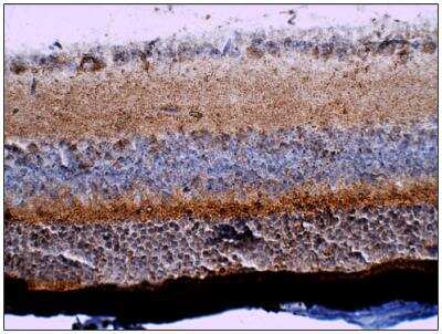 Immunohistochemistry-Paraffin: CRYGS Antibody [NBP3-12222]