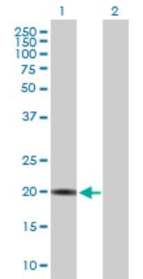 Western Blot: CRYGS Antibody [H00001427-B01P]