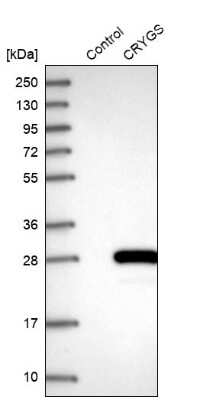 Western Blot: CRYGS Antibody [NBP1-84375]