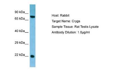 Western Blot: CRYGS Antibody [NBP1-98419]