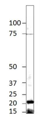 Western Blot: CRYGS Antibody [NBP3-12221]