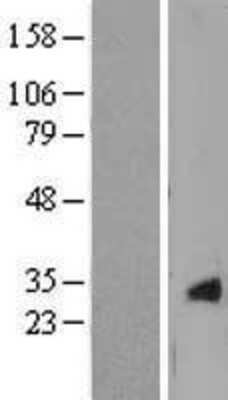 Western Blot: CRYGS Overexpression Lysate [NBL1-09502]