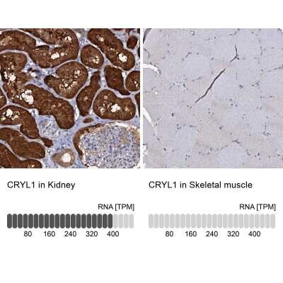 Immunohistochemistry-Paraffin: CRYL1 Antibody [NBP1-93718]