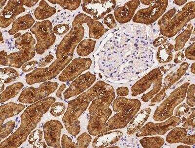 Immunohistochemistry-Paraffin: CRYL1 Antibody [NBP3-06603]