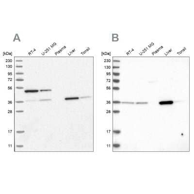 Western Blot: CRYZ Antibody [NBP1-89536]