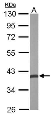 Western Blot: CRYZ Antibody [NBP2-16017]