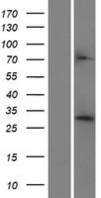 Western Blot: CRYZ Overexpression Lysate [NBP2-09500]