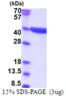 SDS-PAGE: Recombinant Human CRYZ His Protein [NBP2-51762]