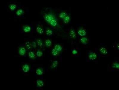 Immunocytochemistry/ Immunofluorescence: CRYZL1 Antibody (OTI2F9) [NBP2-02012]