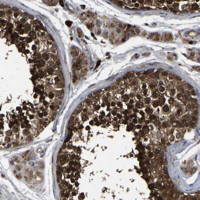 Immunohistochemistry-Paraffin: CRYZL1 Antibody [NBP1-89364]