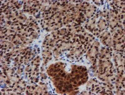 Immunohistochemistry: CRYZL1 Antibody (OTI2F9) - Azide and BSA Free [NBP2-71522]