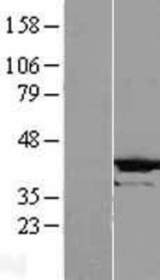 Western Blot: CRYZL1 Overexpression Lysate [NBL1-09504]