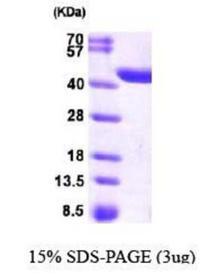 SDS-PAGE: Recombinant Human CRYZL1 His Protein [NBP1-44477]