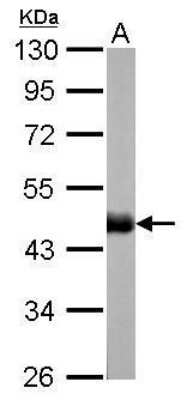 Western Blot: CS Citrate Synthase Antibody (1761) [NBP2-43648]