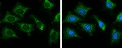 Immunocytochemistry/ Immunofluorescence: CS Citrate Synthase Antibody (2061) [NBP2-43649]