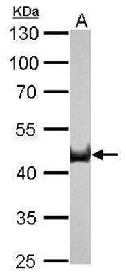Western Blot: CS Citrate Synthase Antibody (2061) [NBP2-43649]