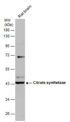 Western Blot: CS Citrate Synthase Antibody (2061) [NBP2-43649]