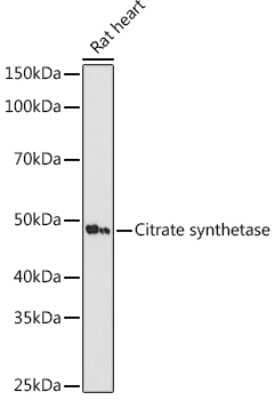 Western Blot: CS Citrate Synthase Antibody (4Z10Z8) [NBP3-16438]