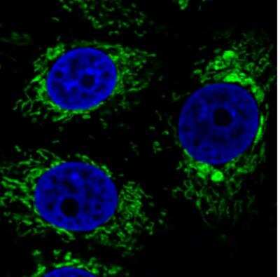 Immunocytochemistry/ Immunofluorescence: CS Citrate Synthase Antibody (CL2545) [NBP2-36771]