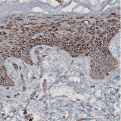 Immunohistochemistry-Paraffin: CS Citrate Synthase Antibody (CL2545) [NBP2-36771]