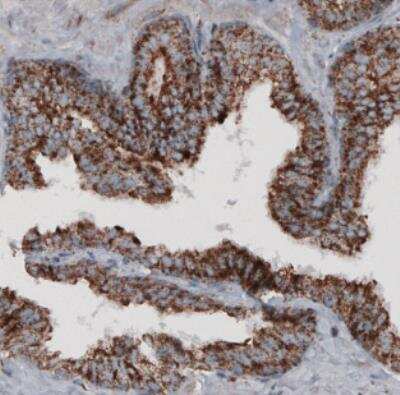Immunohistochemistry-Paraffin: CS Citrate Synthase Antibody (CL2545) [NBP2-36771]
