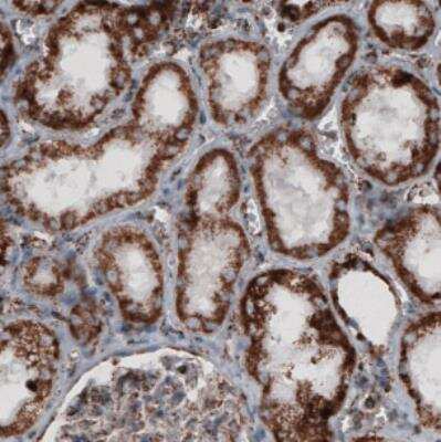 Immunohistochemistry-Paraffin: CS Citrate Synthase Antibody (CL2545) [NBP2-36771]