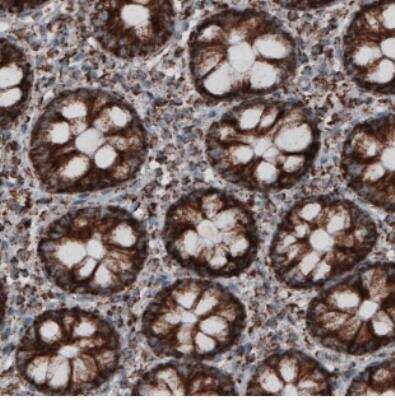 Immunohistochemistry-Paraffin: CS Citrate Synthase Antibody (CL2545) [NBP2-36771]