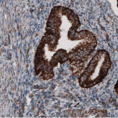 Immunohistochemistry-Paraffin: CS Citrate Synthase Antibody (CL2545) [NBP2-36771]