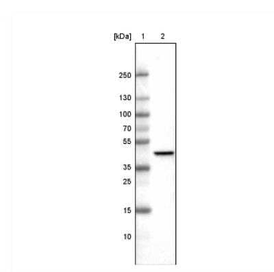 Western Blot: CS Citrate Synthase Antibody (CL2545) [NBP2-36771]