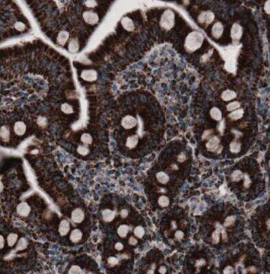 Immunohistochemistry: CS Citrate Synthase Antibody (CL2548) [NBP2-36772]