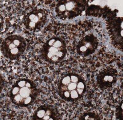 Immunohistochemistry: CS Citrate Synthase Antibody (CL2548) [NBP2-36772]