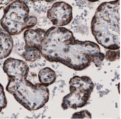Immunohistochemistry: CS Citrate Synthase Antibody (CL2548) [NBP2-36772]