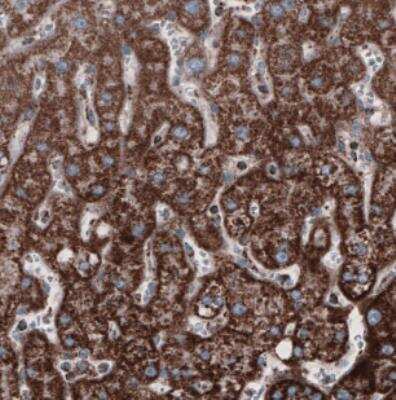 Immunohistochemistry: CS Citrate Synthase Antibody (CL2548) [NBP2-36772]