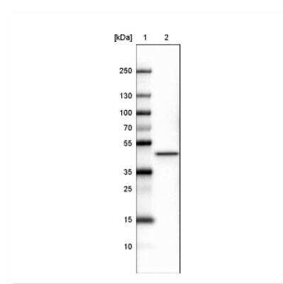 Western Blot: CS Citrate Synthase Antibody (CL2548) [NBP2-36772]