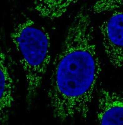 Immunocytochemistry/ Immunofluorescence: CS Citrate Synthase Antibody (CL2553) [NBP2-36773]