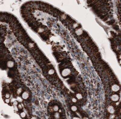 Immunohistochemistry: CS Citrate Synthase Antibody (CL2553) [NBP2-36773]
